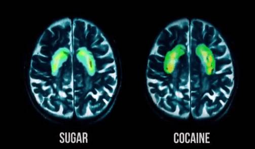 sucre addiction Cocaïne faim sensorielle